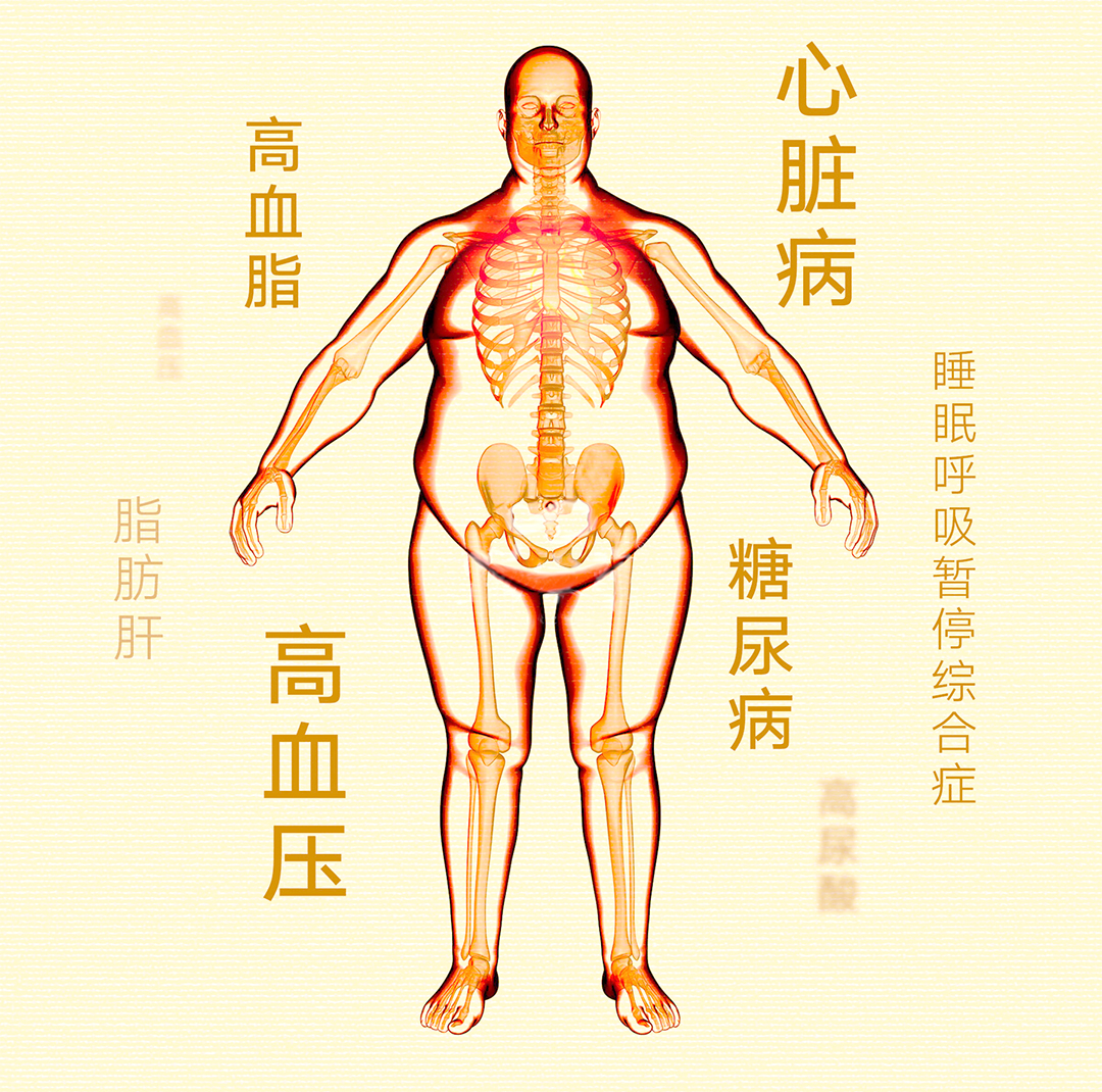 肥胖人群预防骨关节疾病的方法有那些？